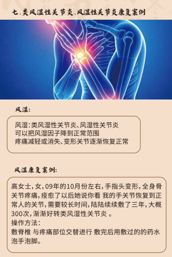 肩周炎康复案例展示，患者接受中药热敷治疗过程，医护人员专业指导，体现治疗效果