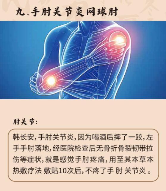 肩周炎康复案例展示，患者接受中药热敷治疗过程，医护人员专业指导，体现治疗效果