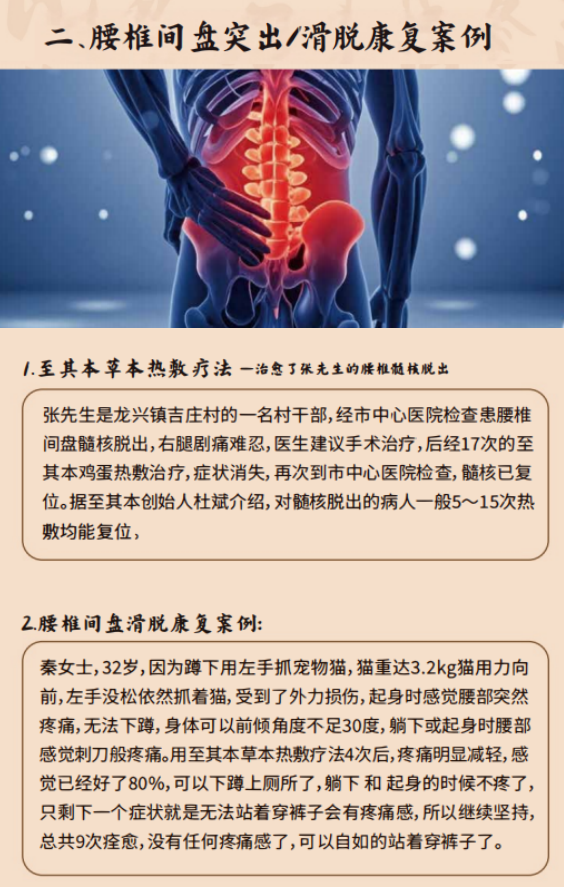 腰椎间盘突出康复案例展示，患者接受中药热敷治疗过程，医护人员专业指导，体现治疗效果